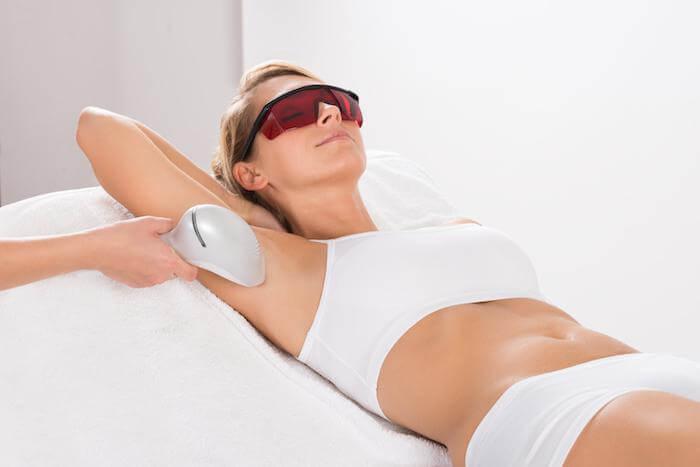 A woman receiving laser hair removal