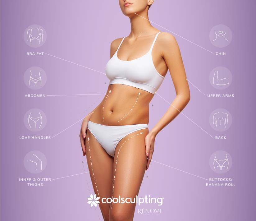 CoolSculpting