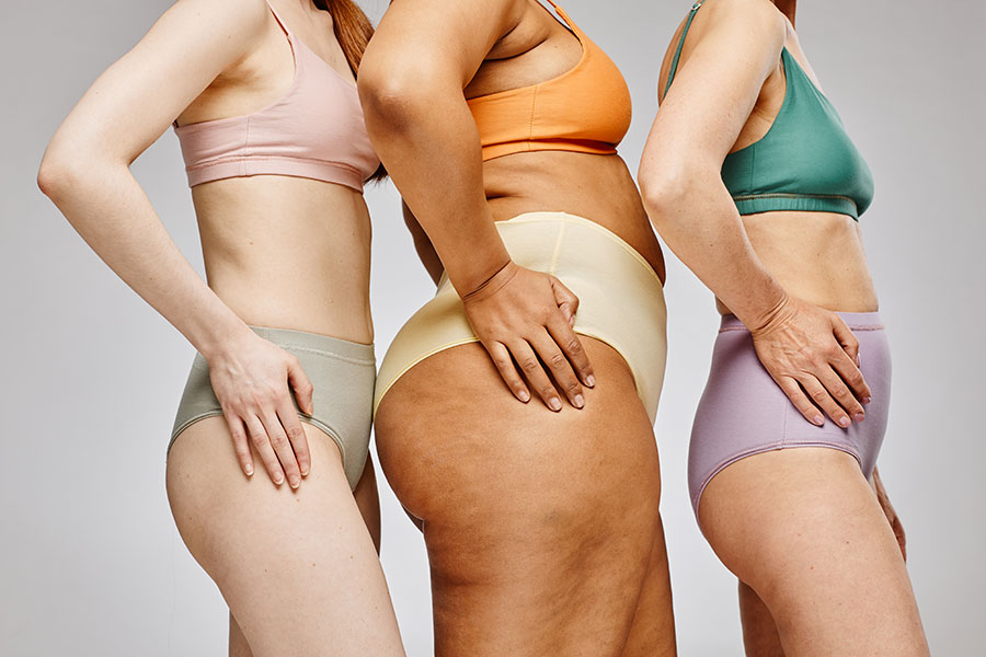 Three women of different sizes and skin color in their undergarments stand with their right sides to the camera, revealing their skin texture