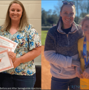 Benefits of Turmeric Tea for Weight Loss