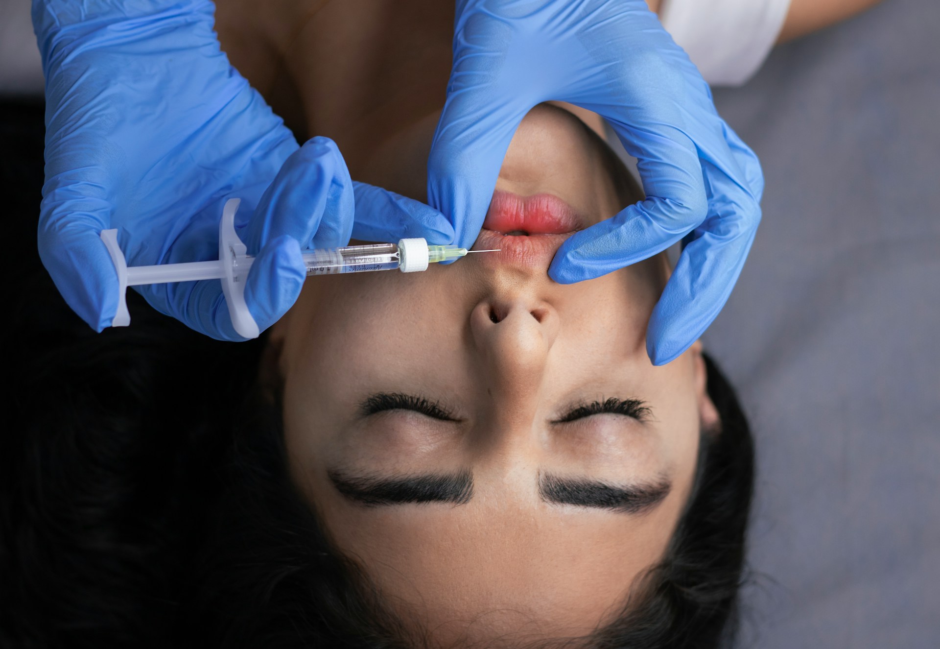 A woman getting a lip filler injection